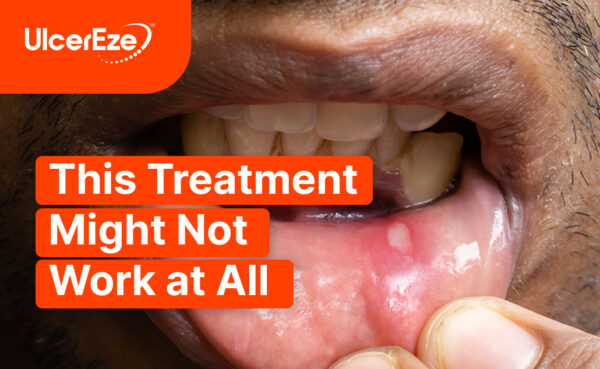 canker sore